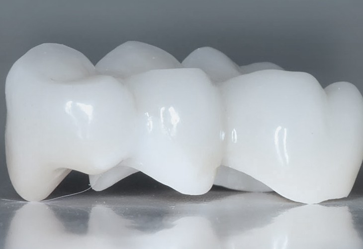 пластмассовые зубные протезы отзывы и цены фото